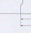 Fuse Switch Disconnector H2-160/TS